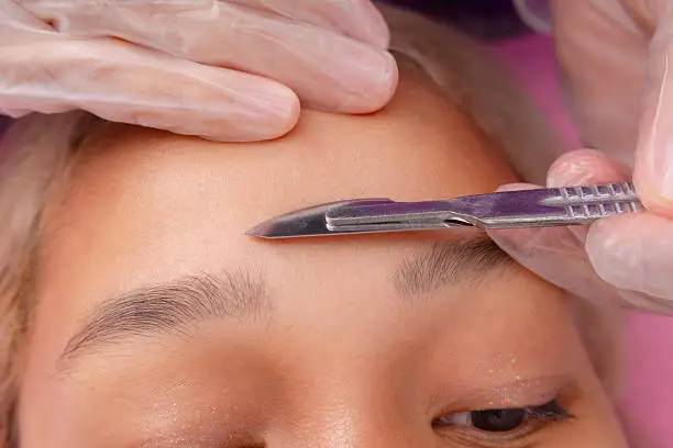 benefits of dermaplaning
